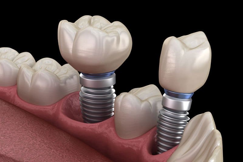 Dental Services in Albuquerque
