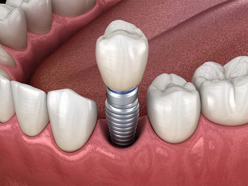 Dental Services in Albuquerque
