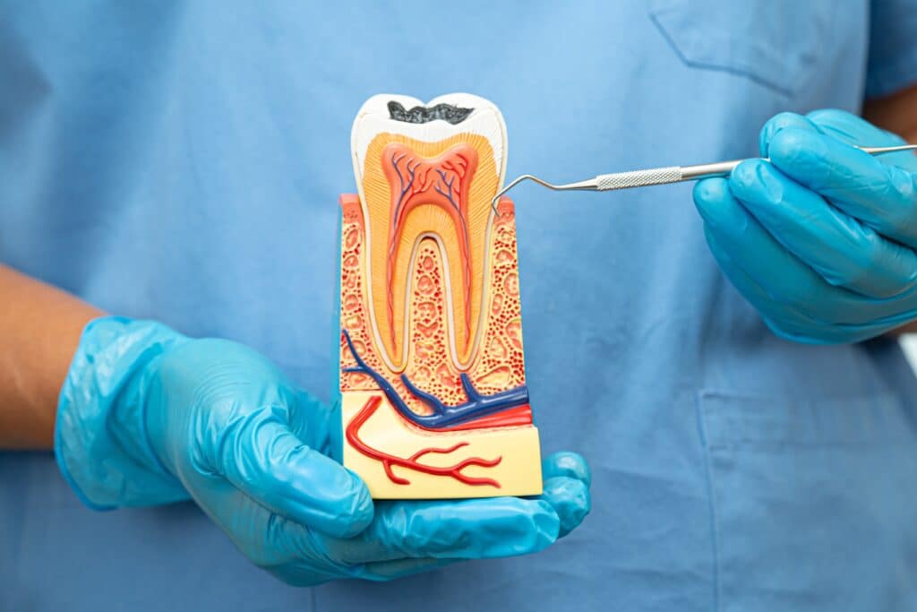root canals albuquerque