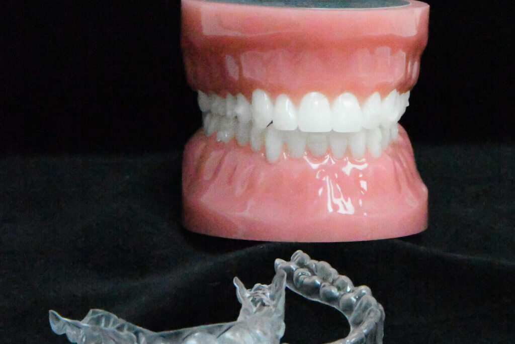 Clarity Clear Aligners